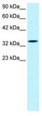 SMAD Family Member 6 antibody, TA331111, Origene, Western Blot image 