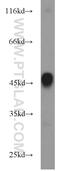 Keratin 36 antibody, 14309-1-AP, Proteintech Group, Western Blot image 
