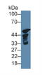 Cytochrome P450 Family 17 Subfamily A Member 1 antibody, abx130937, Abbexa, Western Blot image 