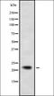 Cytidine/Uridine Monophosphate Kinase 1 antibody, orb378438, Biorbyt, Western Blot image 