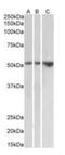 Hepatitis A Virus Cellular Receptor 1 antibody, orb233669, Biorbyt, Western Blot image 