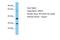 Olfactory Receptor Family 6 Subfamily C Member 6 antibody, A18802, Boster Biological Technology, Western Blot image 