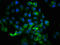 Ribosomal Protein S6 Kinase A1 antibody, CSB-RA618984A359phHU, Cusabio, Immunofluorescence image 