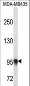 Procollagen-Lysine,2-Oxoglutarate 5-Dioxygenase 3 antibody, LS-C163797, Lifespan Biosciences, Western Blot image 