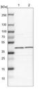 Eukaryotic Translation Initiation Factor 3 Subunit H antibody, NBP1-84870, Novus Biologicals, Western Blot image 