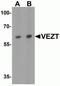 Vezatin, Adherens Junctions Transmembrane Protein antibody, NBP2-82044, Novus Biologicals, Western Blot image 