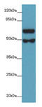 Polypeptide N-Acetylgalactosaminyltransferase 16 antibody, A66946-100, Epigentek, Western Blot image 