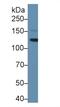 LIF Receptor Subunit Alpha antibody, MBS2002285, MyBioSource, Western Blot image 