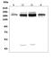 Ubiquitin Protein Ligase E3 Component N-Recognin 2 antibody, A05812-2, Boster Biological Technology, Western Blot image 