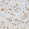 Vir Like M6A Methyltransferase Associated antibody, 16-489, ProSci, Immunohistochemistry paraffin image 
