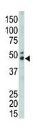 Sphingosine kinase 1 antibody, abx033252, Abbexa, Immunohistochemistry frozen image 