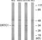Olfactory Receptor Family 7 Subfamily C Member 1 antibody, TA315340, Origene, Western Blot image 