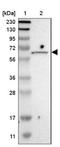 Inositol-3-Phosphate Synthase 1 antibody, NBP2-48513, Novus Biologicals, Western Blot image 