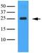 C-Type Lectin Domain Family 4 Member E antibody, ab100846, Abcam, Western Blot image 