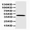 NPHS2 Stomatin Family Member, Podocin antibody, orb146713, Biorbyt, Western Blot image 