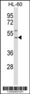 Tachykinin Receptor 1 antibody, 57-338, ProSci, Western Blot image 