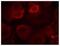 Erb-B2 Receptor Tyrosine Kinase 3 antibody, NBP1-04970, Novus Biologicals, Immunofluorescence image 