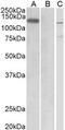 E3 ubiquitin-protein ligase MIB1 antibody, AHP2264, Bio-Rad (formerly AbD Serotec) , Enzyme Linked Immunosorbent Assay image 