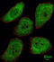 PTTG1 Regulator Of Sister Chromatid Separation, Securin antibody, abx033347, Abbexa, Immunohistochemistry paraffin image 