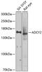 Adenylate Cyclase 2 antibody, 23-910, ProSci, Western Blot image 