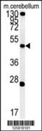 Ectonucleotide Pyrophosphatase/Phosphodiesterase 6 antibody, 61-835, ProSci, Western Blot image 