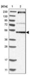 Mitochondrial RRNA Methyltransferase 3 antibody, NBP1-83845, Novus Biologicals, Western Blot image 