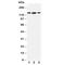 Histone Deacetylase 6 antibody, R30680, NSJ Bioreagents, Western Blot image 