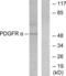 Peripherin antibody, LS-B7614, Lifespan Biosciences, Western Blot image 