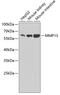 Matrix Metallopeptidase 13 antibody, GTX55707, GeneTex, Western Blot image 