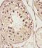 NSFL1 Cofactor antibody, M08116, Boster Biological Technology, Immunohistochemistry paraffin image 