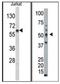 Glucokinase antibody, GTX59599, GeneTex, Western Blot image 