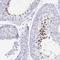 Zona Pellucida Binding Protein antibody, NBP2-31726, Novus Biologicals, Immunohistochemistry paraffin image 