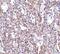 Stromal Interaction Molecule 1 antibody, NBP1-76789, Novus Biologicals, Immunohistochemistry paraffin image 