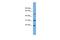 Crystallin Beta A4 antibody, A09905, Boster Biological Technology, Western Blot image 