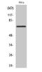 DEAD-Box Helicase 55 antibody, A12850-2, Boster Biological Technology, Western Blot image 