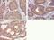 Protein Tyrosine Kinase 2 antibody, 700255, Invitrogen Antibodies, Immunohistochemistry paraffin image 