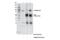 Hyaluronan Mediated Motility Receptor antibody, 55463S, Cell Signaling Technology, Immunoprecipitation image 