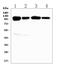 Vascular Cell Adhesion Molecule 1 antibody, A01199, Boster Biological Technology, Western Blot image 