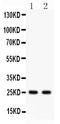 RAB3A, Member RAS Oncogene Family antibody, PB9322, Boster Biological Technology, Western Blot image 