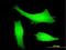 Itchy E3 Ubiquitin Protein Ligase antibody, H00083737-M06, Novus Biologicals, Immunofluorescence image 