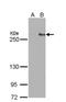 Tet Methylcytosine Dioxygenase 1 antibody, NBP2-15135, Novus Biologicals, Western Blot image 
