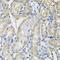 Mitochondrial Ribosomal Protein S22 antibody, GTX65972, GeneTex, Immunohistochemistry paraffin image 