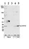 Ribosomal Protein S6 antibody, ab70227, Abcam, Western Blot image 