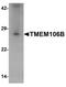 Transmembrane Protein 106B antibody, PA5-34353, Invitrogen Antibodies, Western Blot image 