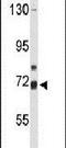 Arachidonate 15-Lipoxygenase Type B antibody, PA5-26208, Invitrogen Antibodies, Western Blot image 