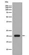 Colony Stimulating Factor 1 antibody, M00620, Boster Biological Technology, Western Blot image 