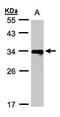 Major Histocompatibility Complex, Class II, DR Beta 4 antibody, TA308898, Origene, Western Blot image 