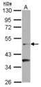 Nuclear Receptor Subfamily 6 Group A Member 1 antibody, NBP2-16625, Novus Biologicals, Western Blot image 