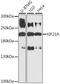Kinesin Family Member 21A antibody, A03734, Boster Biological Technology, Western Blot image 