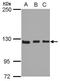 Integrin Subunit Alpha 9 antibody, PA5-27771, Invitrogen Antibodies, Western Blot image 